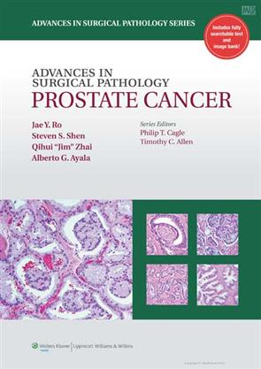 Advances in Surgical Pathology- Prostate Cancer