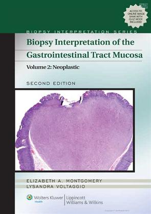Biopsy Interpretation of the Gastrointestinal Tract Mucosa Volume 2 - Neoplastic 2nd Edition