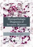 Histopathologic Diagnosis Of Invasive Mycoses (Pb 2023)